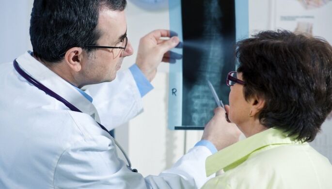 X-quang cột sống bị hoại tử xương