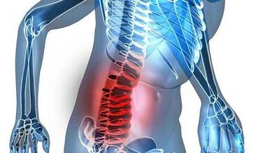Dấu hiệu và triệu chứng của bệnh xương khớp thắt lưng