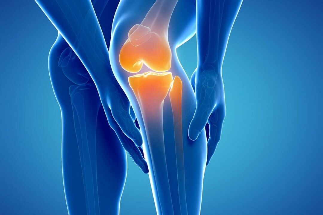 Arthrosis là gì
