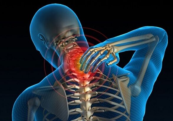 đau cổ do thoái hóa xương khớp