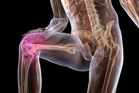 đau khớp do viêm khớp gối